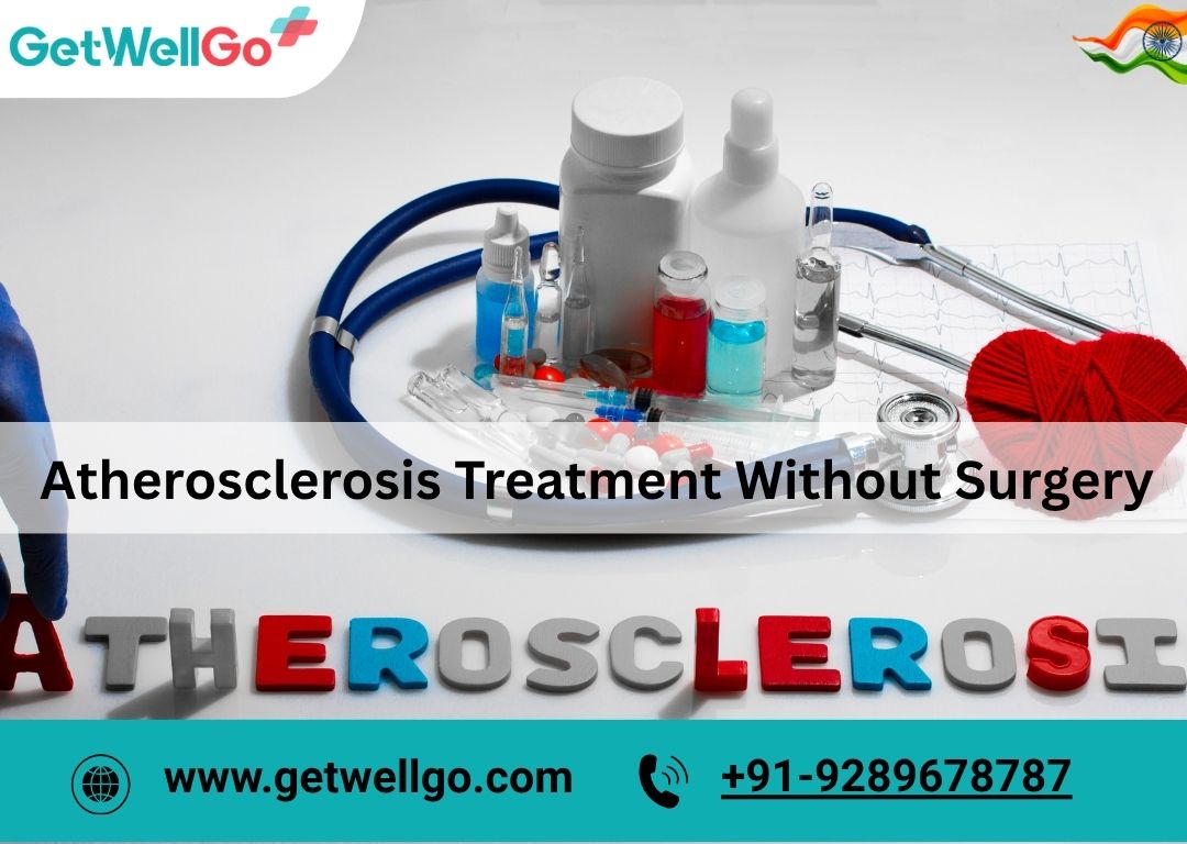 Non Surgical Options For Atherosclerosis Treatment